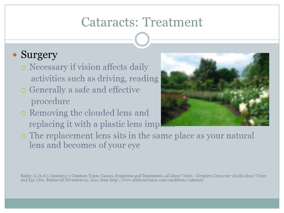 Phacoemulsification for cataracts